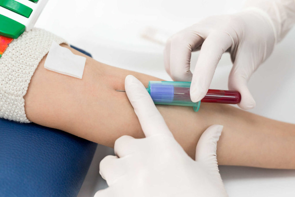 Diabetes insípida: análisis de sangre