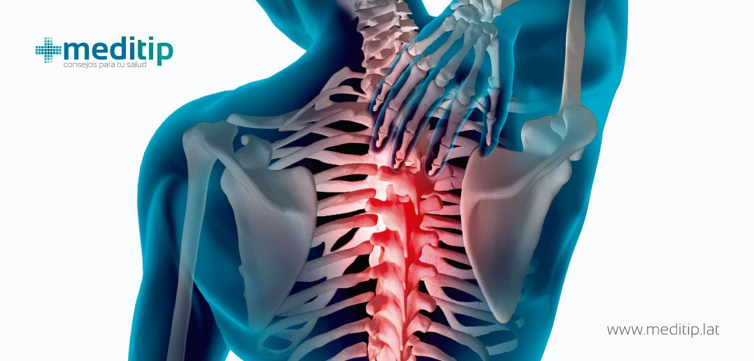 Tipos de dolor de espalda 