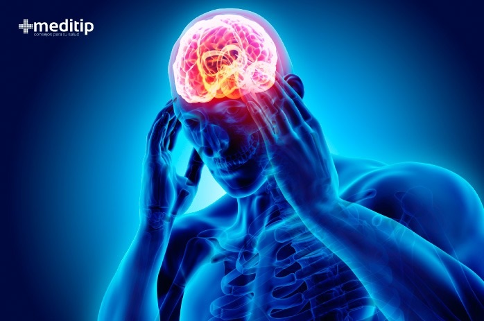 Causas del dolor de cabeza: migraña